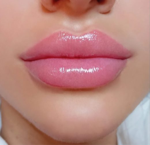 Cropped left panel: lighter-skinned client's lips
