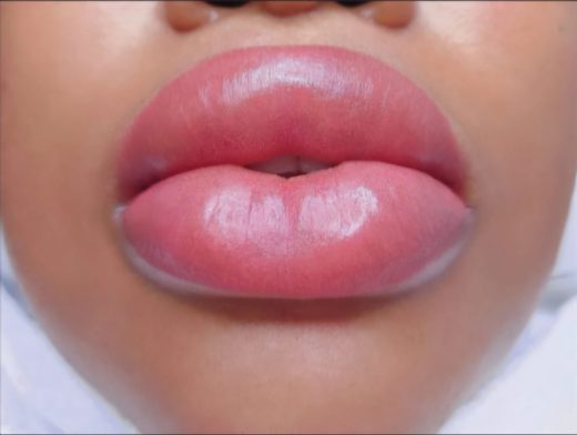 Cropped right panel: darker-skinned client's lips