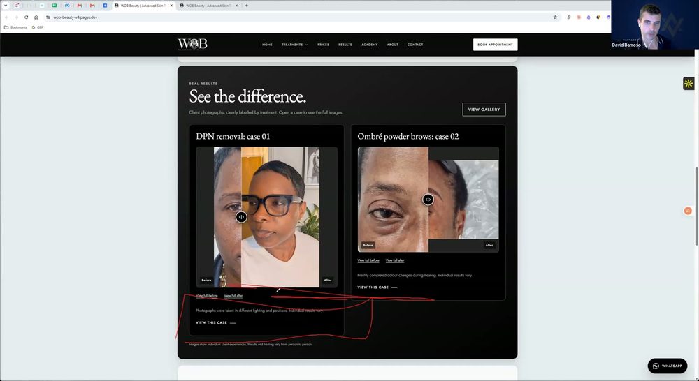 Call frame: the homepage See the difference section with a red annotation circling the misaligned case cards